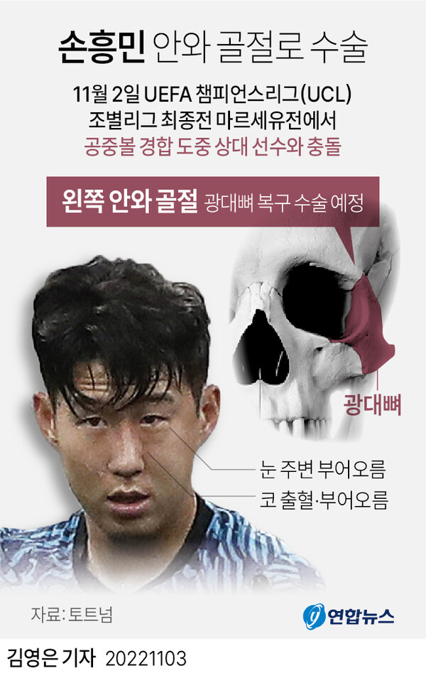손흥민이 수술을 받게 되는 부상 부위 [그래픽=연합뉴스]